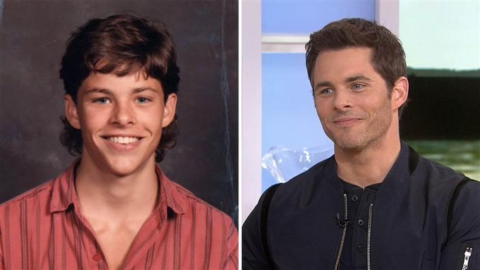 James Marsden before and after pictures. 