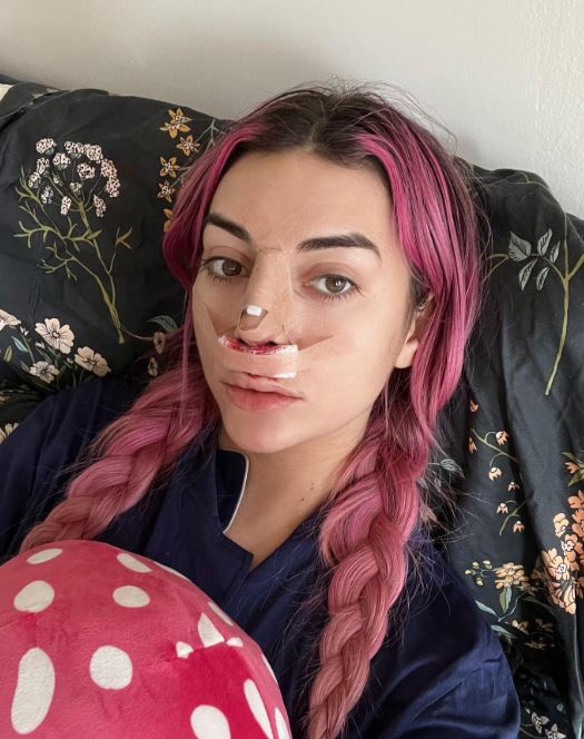 Brianna Chickenfry reveals her nose job photo