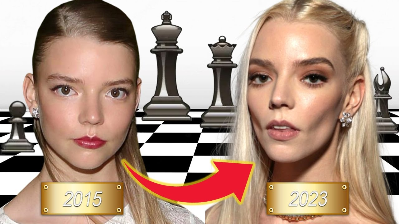 Anya Taylor-Joy is rumored to have undergone plastic surgery. 