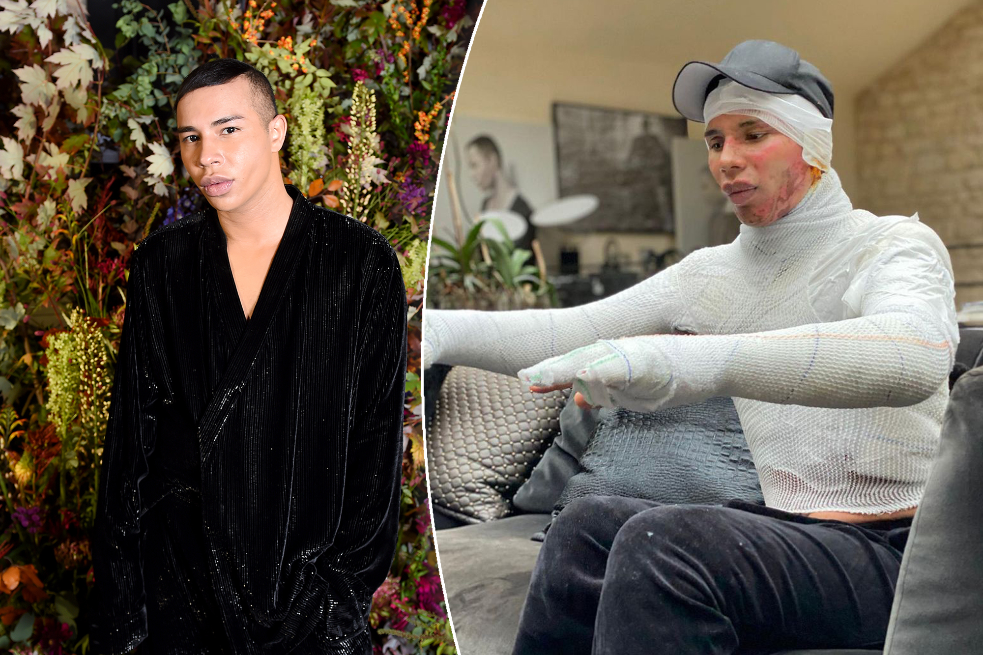 Olivier Rousteing revealed his gruesome injuries. (Source: Page Six)