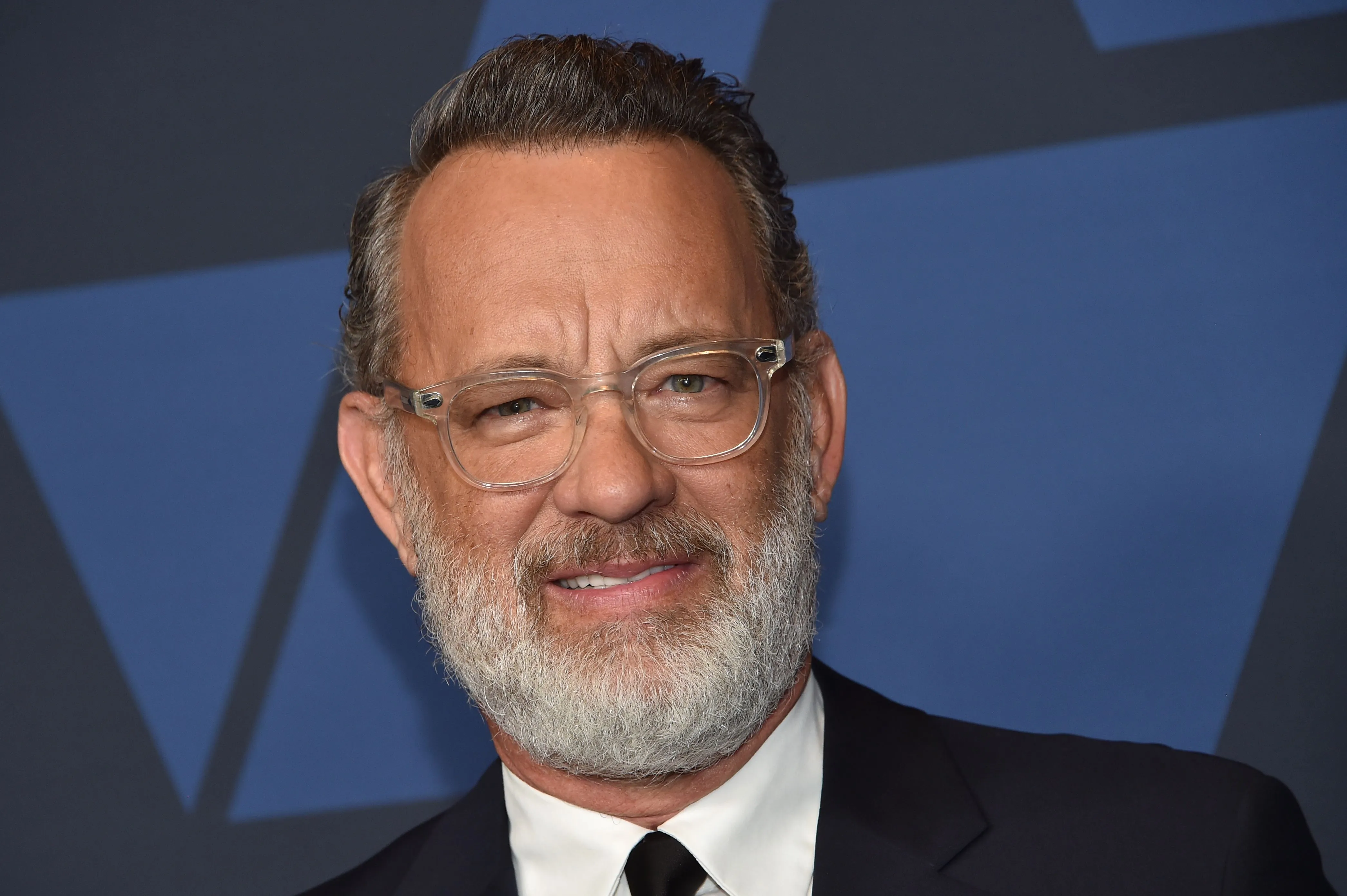 Tom Hanks now boasts a fuller hairline after getting a hair transplant