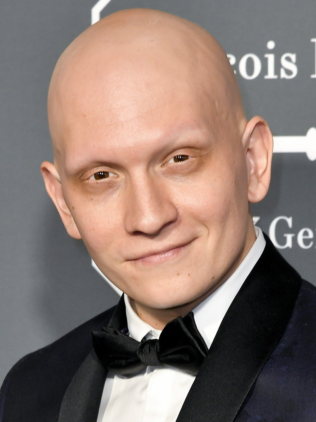 Anthony Carrigan has a health condition called alopecia areata
