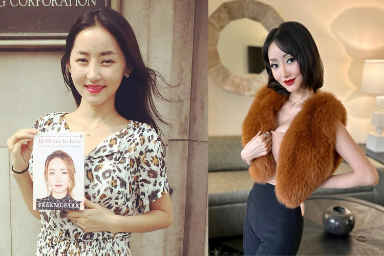 Before and After pictures of Yeonmi Park
